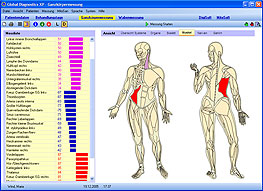 Der Global Diagnostics