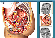 Oberon Diagnosebilder weibliches Becken